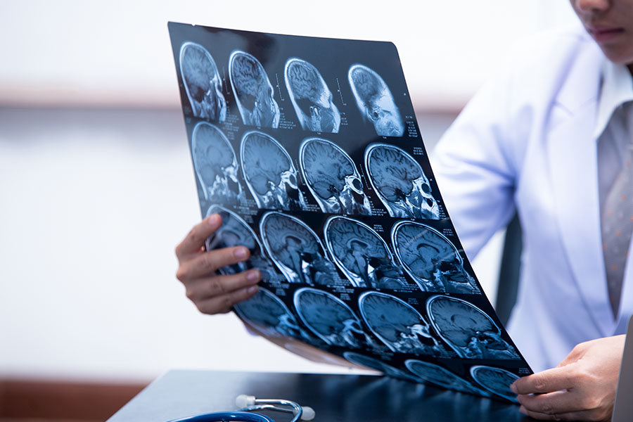 What to Look for in a Brain Injury Lawyer: A Comprehensive Guide - Featured Image